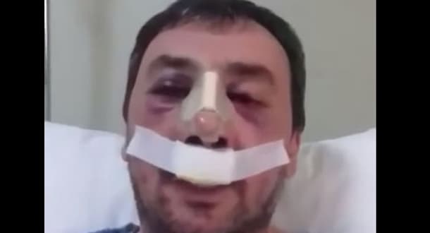 Tanınmış meyxanaçımız xəstəxanalıq oldu: “Qız uşağı deyiləm” (VİDEO)