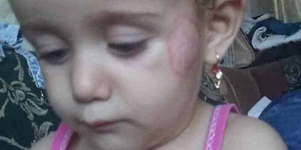 Gəncədə bağçada körpəyə dağ çəkdilər (FOTO)