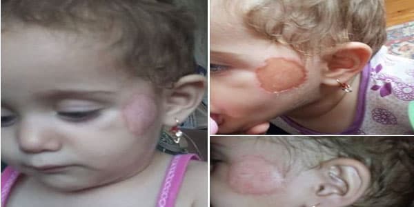 Bağçada körpəyə işgəncə verildi: 2 nəfər işdən çıxarıldı, müdirə töhmət verildi