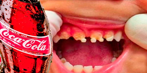 “Coca-Cola” – içki, yoxsa xəstəlik mənbəyi? (VİDEO)
