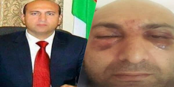 Özbəkistandakı diaspor sədrimiz döyüldü - TƏFƏRRÜAT