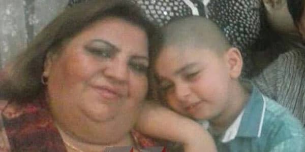 Azərbaycanda daha bir qadın estetik əməliyyatın qurbanı oldu (FOTO)