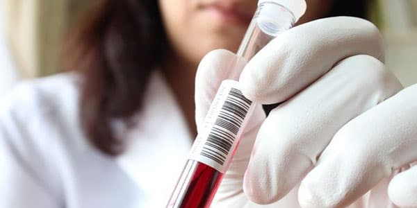 Hepatitli xəstələrə hansı pulsuz dərmanlar verilir? (AÇIQLAMA)