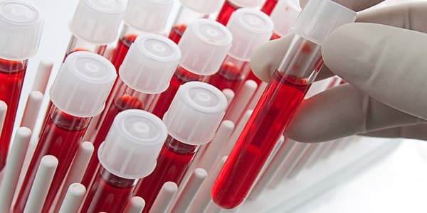 4000-ə yaxın şəxs HIV, hepatit B və C virusuna yoluxmuş ola bilər