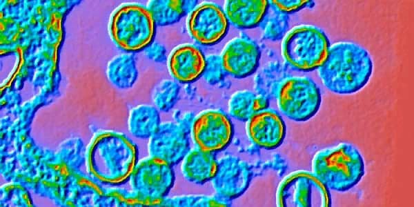 Ölümcül virus 9 nəfərin həyatına son qoydu: müalicəsi yoxdur