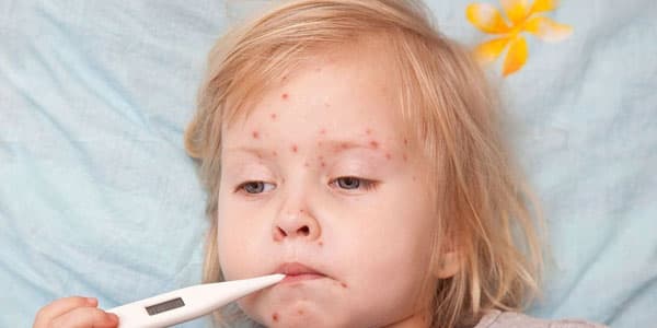 Gürcüstanda qızılca epidemiya həddinə çatıb, əhali pulsuz peyvənd olunacaq