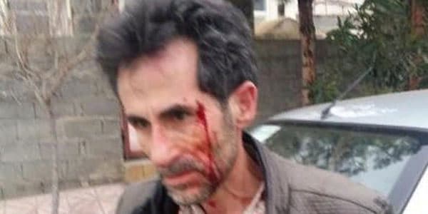Güneyli siyasi fəal evinin qarşısında vəhşicəsinə döyüldü (FOTO)