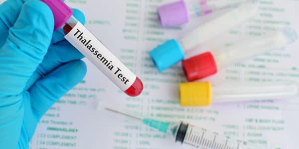 Azərbaycanda üç nadir beta-talassimik mutasiya aşkar edilib