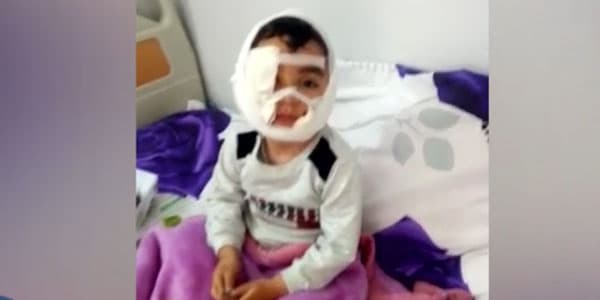 Küçə itinin dişlədiyi Hüseynin atası: “Uşağı metrlərlə sürüyüb” (VİDEO)