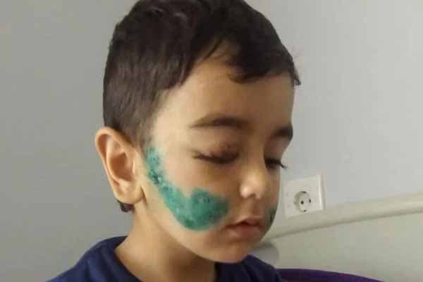 Üz-gözünü it parçalayan uşaqdan xəbər var