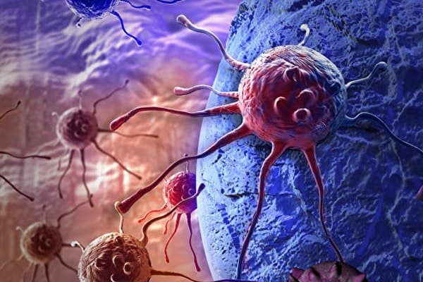 Yaxın illərdə biopsiya olmayacaq - Xərçəng müayinəsində yenilik