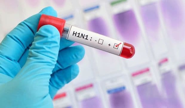 İranda qrip epidemiyası tüğyan edir: Bir həftəyə 110 qurban...