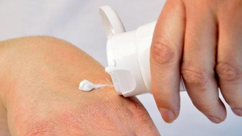 Qışda daha çox yaranan dəri problemi: Quruluq nədən yaranır?