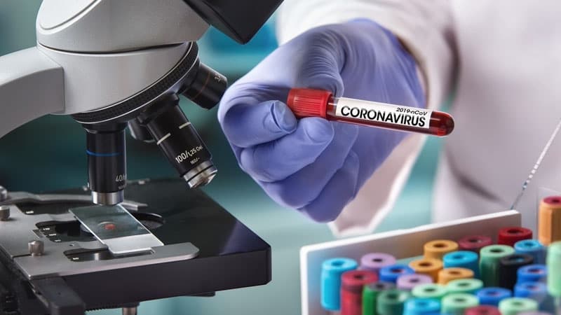 Koronavirus aşkarlanan Azərbaycan vətəndaşlarının yaşları açıqlandı