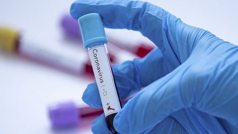 İrandan qayıdan daha iki azərbaycanlıda koronavirus aşkarlandı