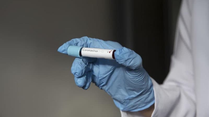 Azərbaycanda daha 4 nəfərdə koronavirus aşkarlandı