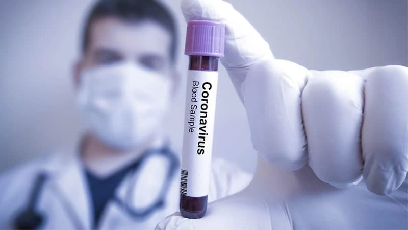 Azərbaycanda 10 yeni koronavirusa yoluxma faktı qeydə alındı