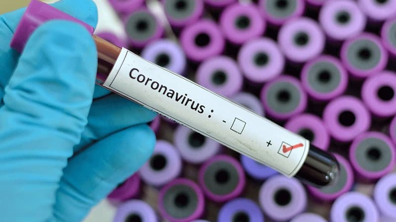 Azərbaycanda daha 7 yeni koronavirusa yoluxma qeydə alındı