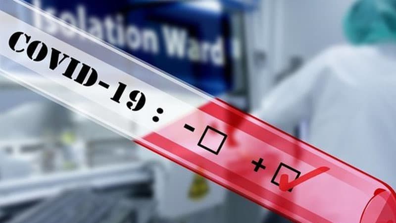 Rusiya ultrasürətli koronavirus testi yaratdı