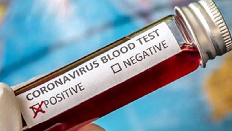 Rus yazıçıdan sensasiya: Koronavirus yoxdur, məqsəd...