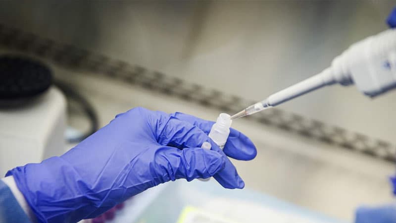Qərargah: Ölkədə koronavirusa görə 30 minə yaxın insan test edilib