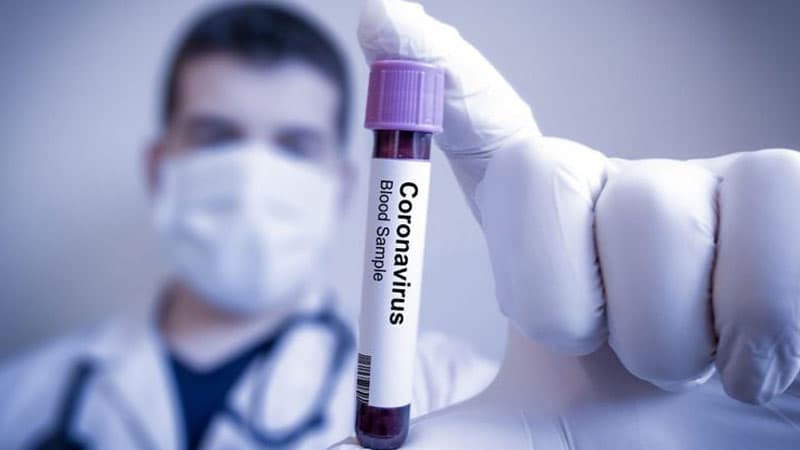 Koronavirusla Mübarizəyə Dəstək Fonduna nə qədər pul köçürülüb? (MƏBLƏĞ)