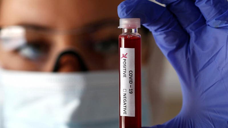 Azərbaycanda koronavirusun statistikası: Neçə nəfər yoluxub, neçə nəfər sağalıb? 