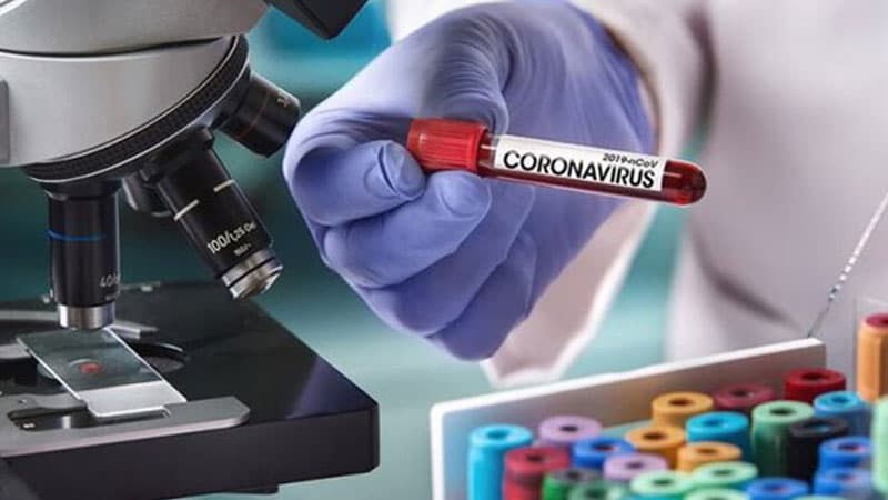 Azərbaycan koronavirus müayinələrinin sayına görə liderlər sırasındadır (FOTO)