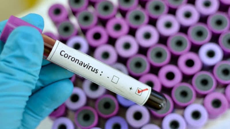 Azərbaycanda koronavirusa yoluxanların sayı kəskin artdı (RƏSMİ)