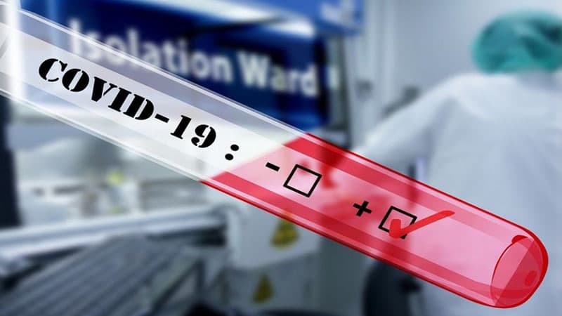 Koronavirus Azərbaycana hansı ölkədən gəlib? (ŞƏRH)