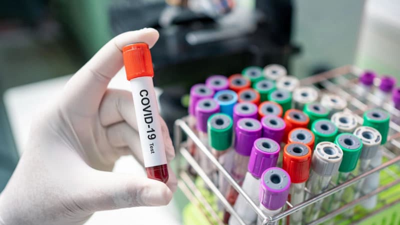Koronavirus ən çox hansı ölkələrdə yayılıb? (SİYAHI)