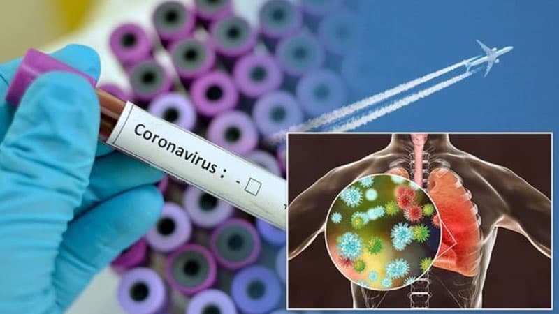 Ermənistanda koronavirusa yoluxanların sayı mini ötdü