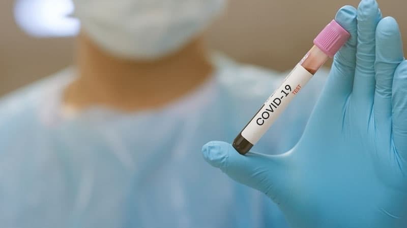 Son sutkada Azərbaycanda neçə nəfər koronavirusa yoluxub? (RƏSMİ)