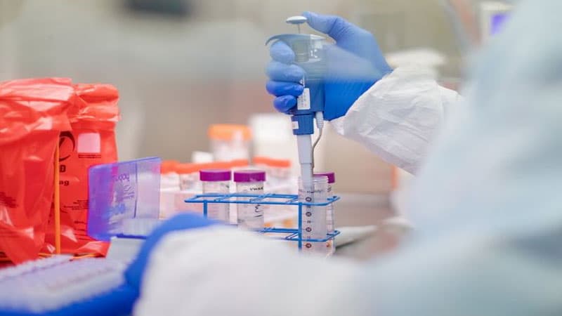 Azərbaycanda koronavirusla bağlı testlərin aparılmasında unikal sistem yaradılıb