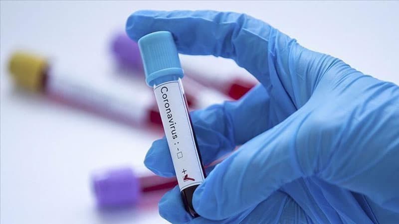 ABŞ-dan sevindirici xəbər: Koronavirusun dərmanı tapıldı