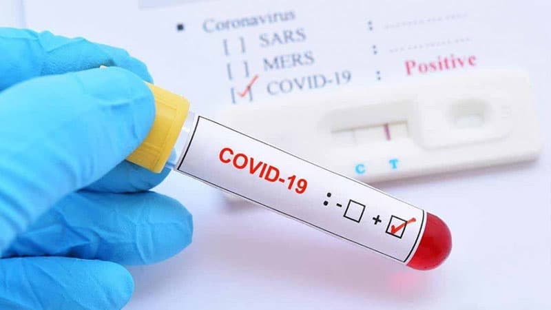 Azərbaycanda daha 50 nəfər koronavirusa yoluxub, 40 nəfər sağaldı 