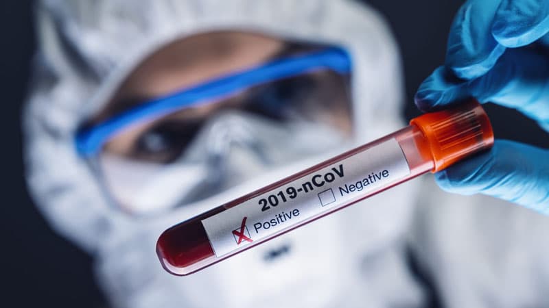 Azərbaycanda koronavirus ilə bağlı son 24 saatın statistikası