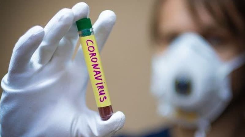 Koronavirus Yer sakinlərinə nə qədər ziyan vurub?