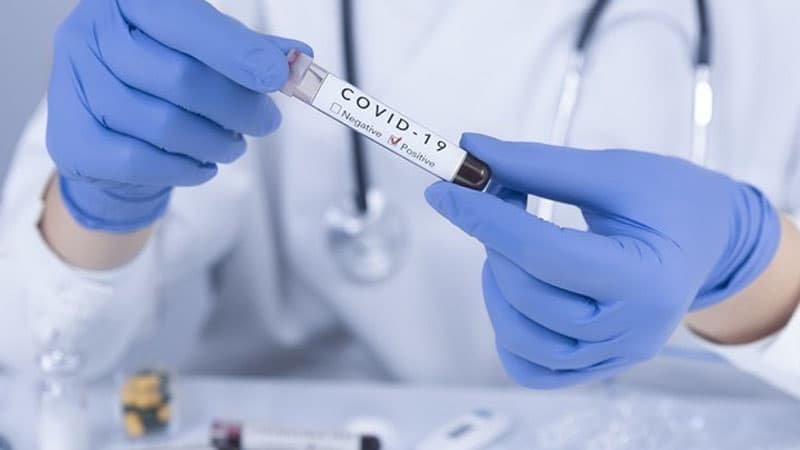 Azərbaycanda son 24 saatda koronavirusa yoluxanların sayı kəskin artdı