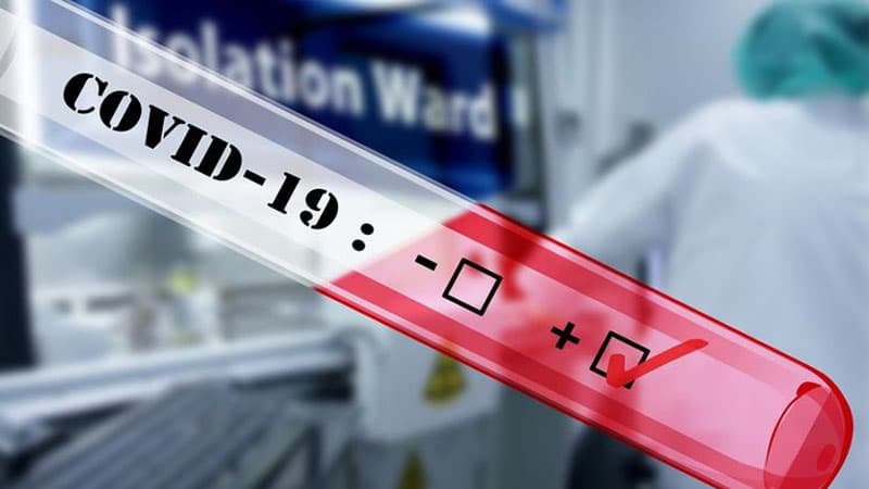 Son 24 saatda Azərbaycanda koronavirusun statistikası (RƏSMİ)