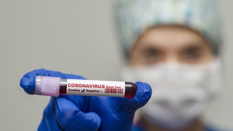 Azərbaycanda koronavirusla bağlı bugünkü test sayı açıqlandı (STATİSTİKA)