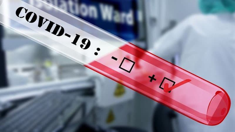 Naxçıvanda indiyədək koronavirusa yoluxan və ölənlərin sayı açıqlandı (RƏSMİ)