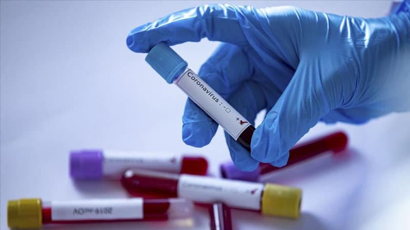 Bu nazirliyin 15 əməkdaşında koronavirus aşkarlandı - RƏSMİ AÇIQLAMA
