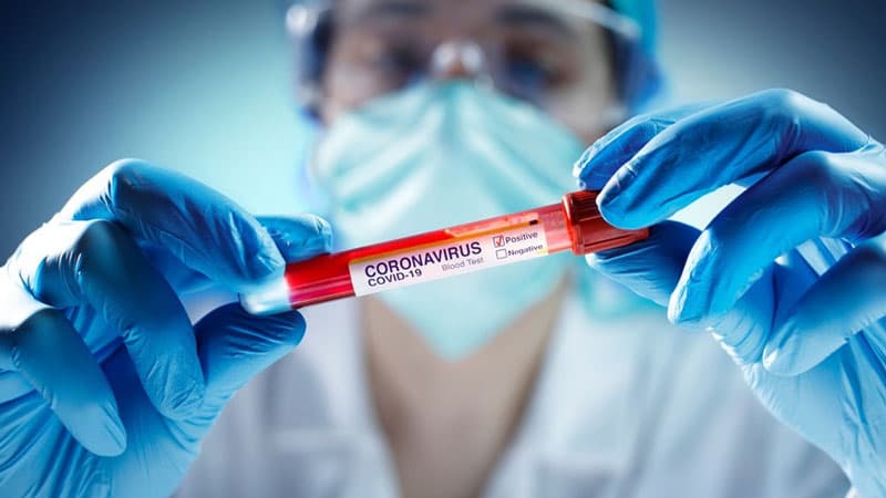 Azərbaycanda daha 101 nəfərdə koronavirus aşkarlandı, 53 nəfər sağaldı