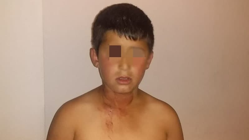 Bakı polisi: Azyaşlının dilənçiliyə cəlb edilməsi faktı təsdiqini tapmayıb
