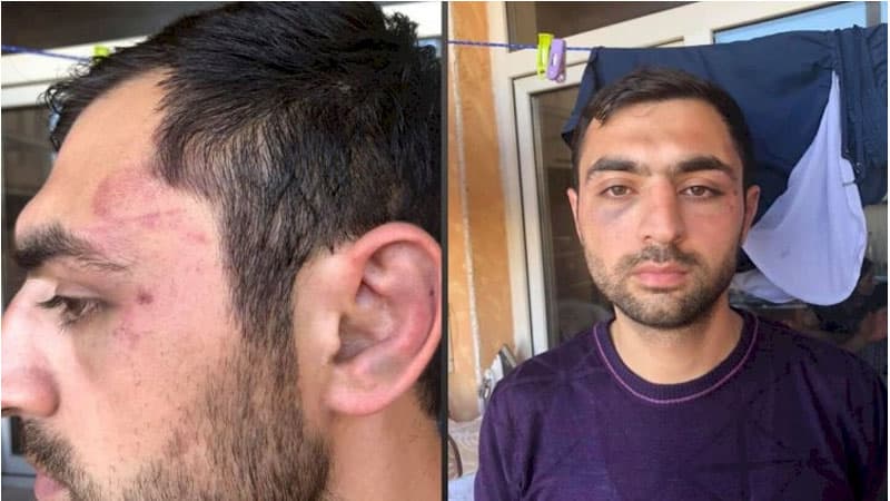 Elvin Süleymanlının polisdə döyülməsi haqda açıqlama