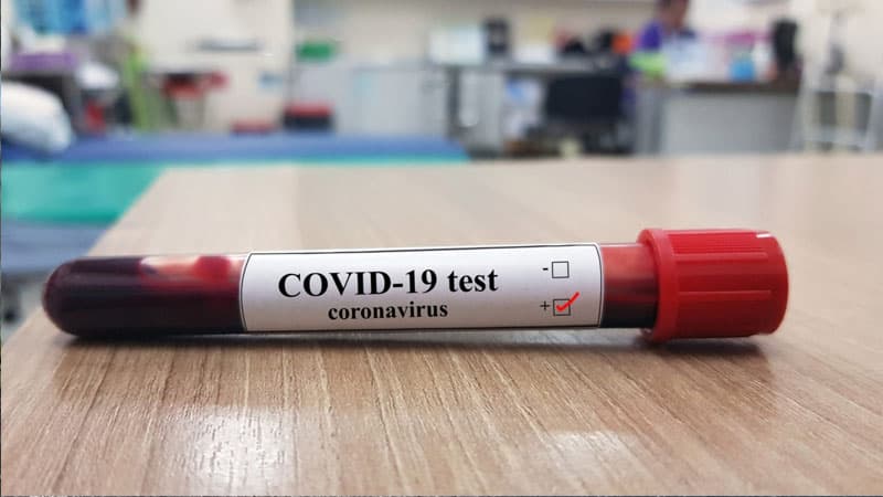 Azərbaycanda daha bir kənddə koronavirus yayıldı