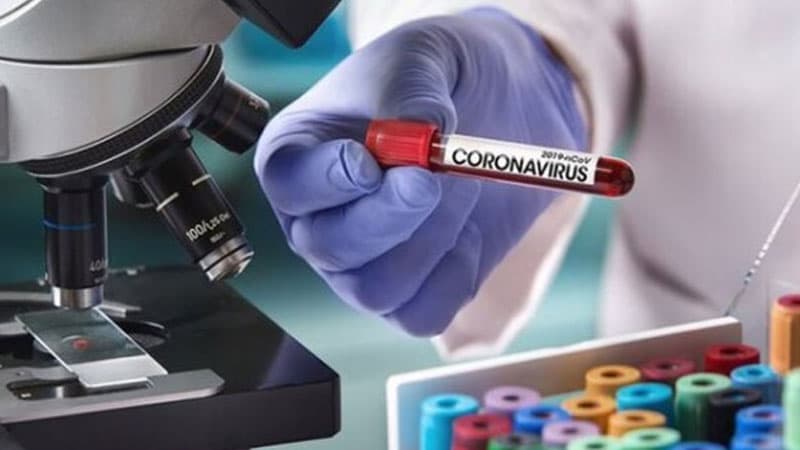 Azərbaycanda 130 COVİD-19 xəstəsi reanimasiyadadır (FOTO)