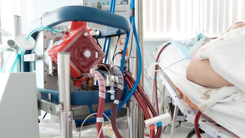 Bəhram Bağırzadənin qoşulduğu ECMO aparatında insan neçə gün qala bilər?