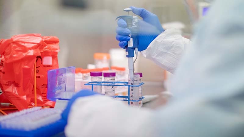 Azərbaycanda daha 329 nəfərdə koronavirus aşkarlandı, yeddi nəfər öldü